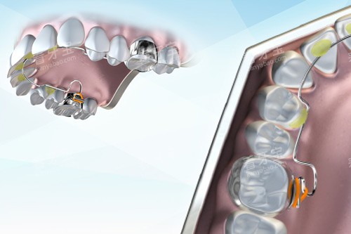 ������ʾ��ͼ