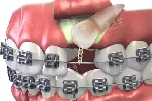 ����ǣ��