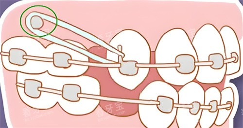 ���ݽ�����ͨͼƬ