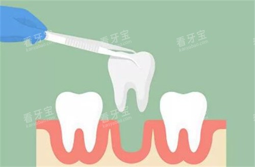 ���ݰγ�����ͼ