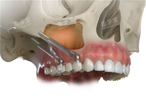 ��ȧ��ֲͼʾ