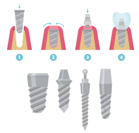 ��ֲ�����ͼ