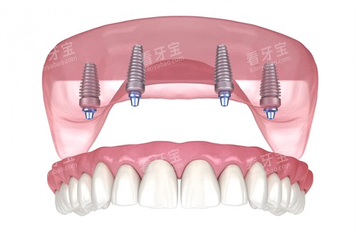 �����ֲ��չʾ