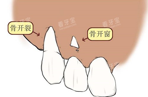 �ǿ�����ͨʾ��ͼ