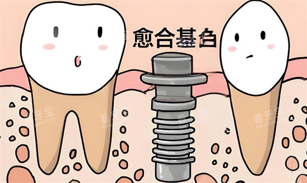 ��ֲ����ͨ����ͼƬչʾ