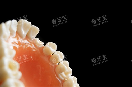 牙齿修复图示 牙齿修复图示