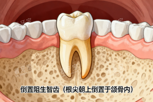 ���������ǳ�һ��