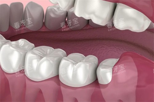 ��������ס�ǳ�