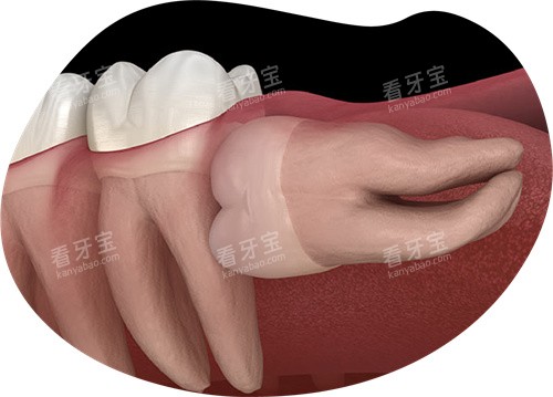 �����ǳ�