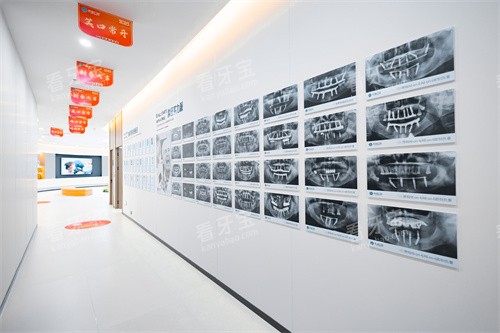 �������ؿ�ǻ�ڲ�չʾͼ