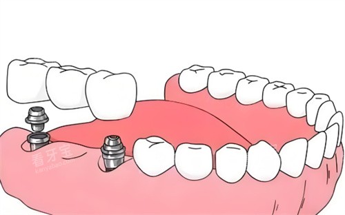 ��ֲ�����Ͽ�ͨչʾͼ