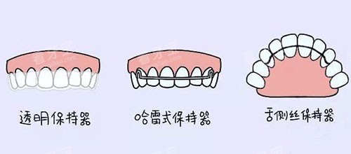 牙齿矫正正畸保持器漫画图 牙齿矫正正畸保持器漫画图