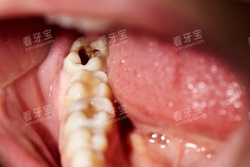 �ǳ������Ѿ��ÿ�ʾ��ͼ