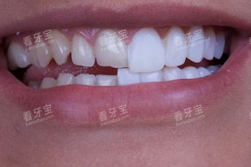 ��������Ա�ͼ