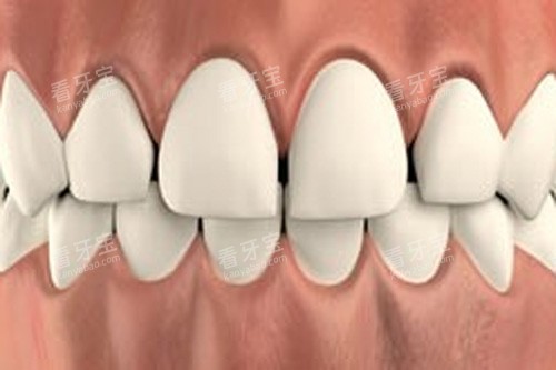 ����ϡ��ʾ��ͼ