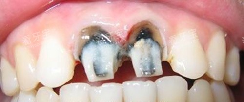 ������ǰ���ݵ����