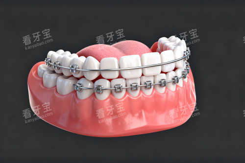 ��ͳ����������չʾͼ