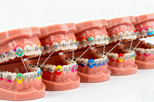 ��ͳ������ģ��ͼ