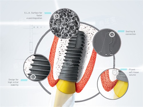 ����˹��ֲ��ϸ�ڷŴ�