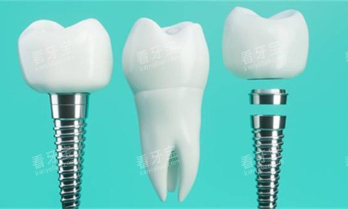 ��ֲ���Ʒ��ͨͼ