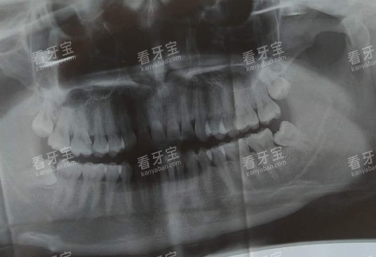 ��ǻ����ct��Ƭ