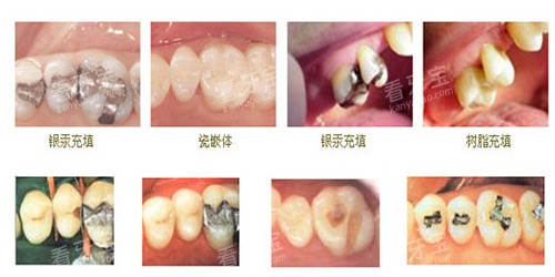 ��ݸ�������Ƽ۸�󹫿���2026�겹��168Ԫ���ǳ�650Ԫ������3000Ԫ�����5000Ԫ��