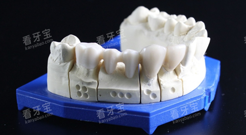 牙齿模型图 牙齿模型图