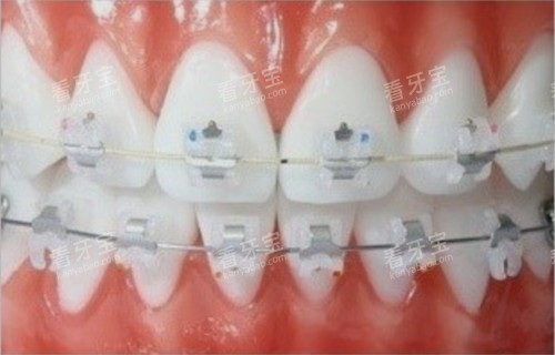 �մ�����ʵ��ģ��ʾ��ͼ