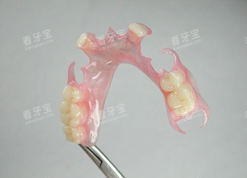 ��ڻ����չʾ