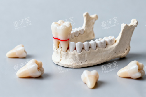 牙齿模型图片一览 牙齿模型图片一览