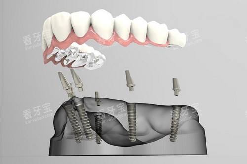 all-on-6��ֲ��ͨһ��ͼ