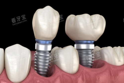 ��ֲ���޸���ͨһ��