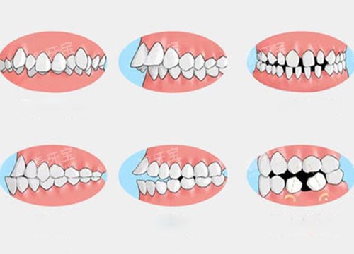 ��Ҫ���ݽ���������1