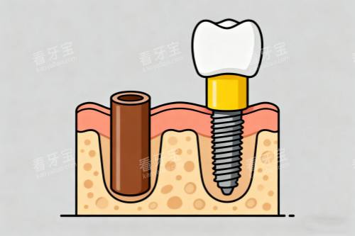 ������ֲ����ͨͼչʾ