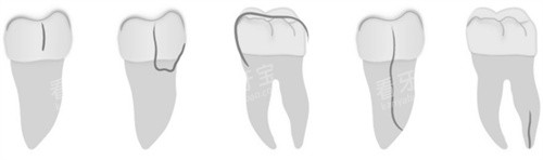 �������Ʒ���