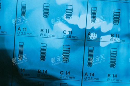 Ankylos���ǵ���ֲ