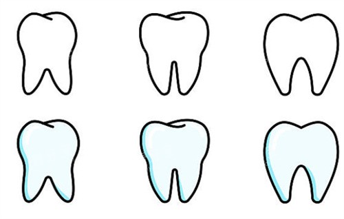 牙齿不同状态 牙齿不同状态