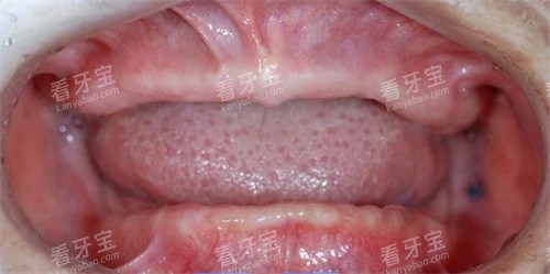 ȫ����������ʾ��ͼ