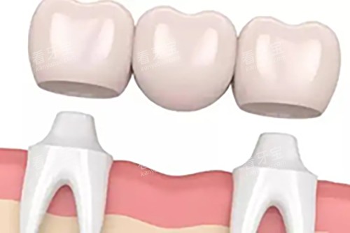 �̶���ݰ�װʾ��ͼ