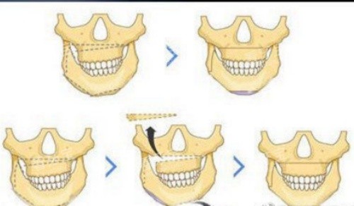 �������ʾ��ͼ