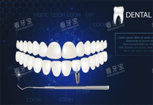 ���ݿ�ͨͼʾCJͼ