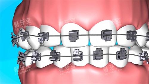 �����в۽���