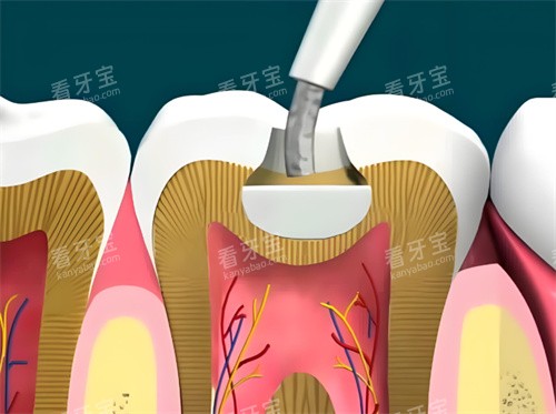 ��֬��������չʾ