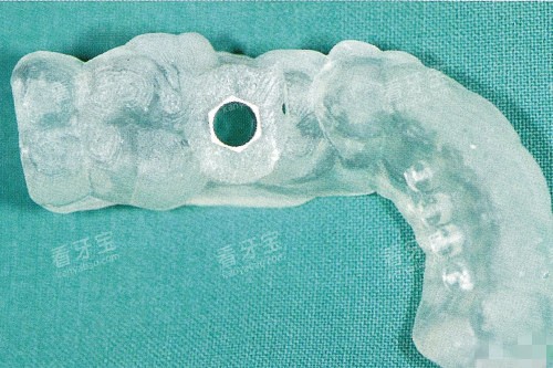 ������ֲ������