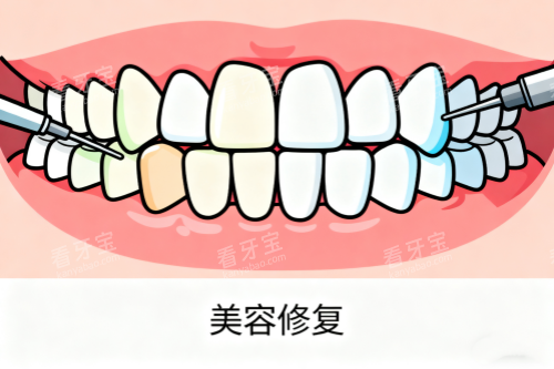 牙齿美容修复卡通图 牙齿美容修复卡通图