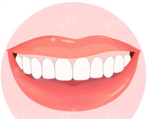 牙齿贴片效果图 牙齿贴片效果图