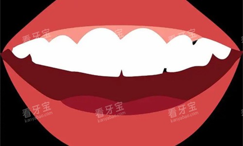 �������뿨ͨͼ