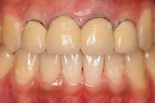 ���ɹ���������