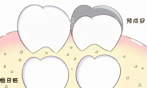 ����Ԥ�ɹ�չʾ