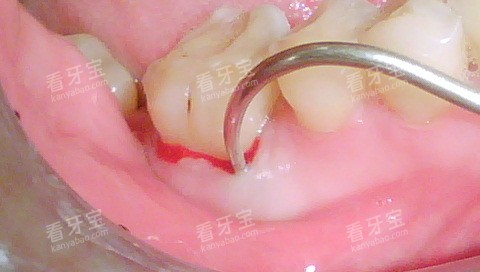 ���ܹ���ʾ��ͼ